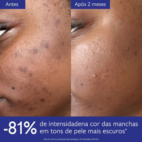 Kit Rotina Iluminadora Caudalie Vinoperfect